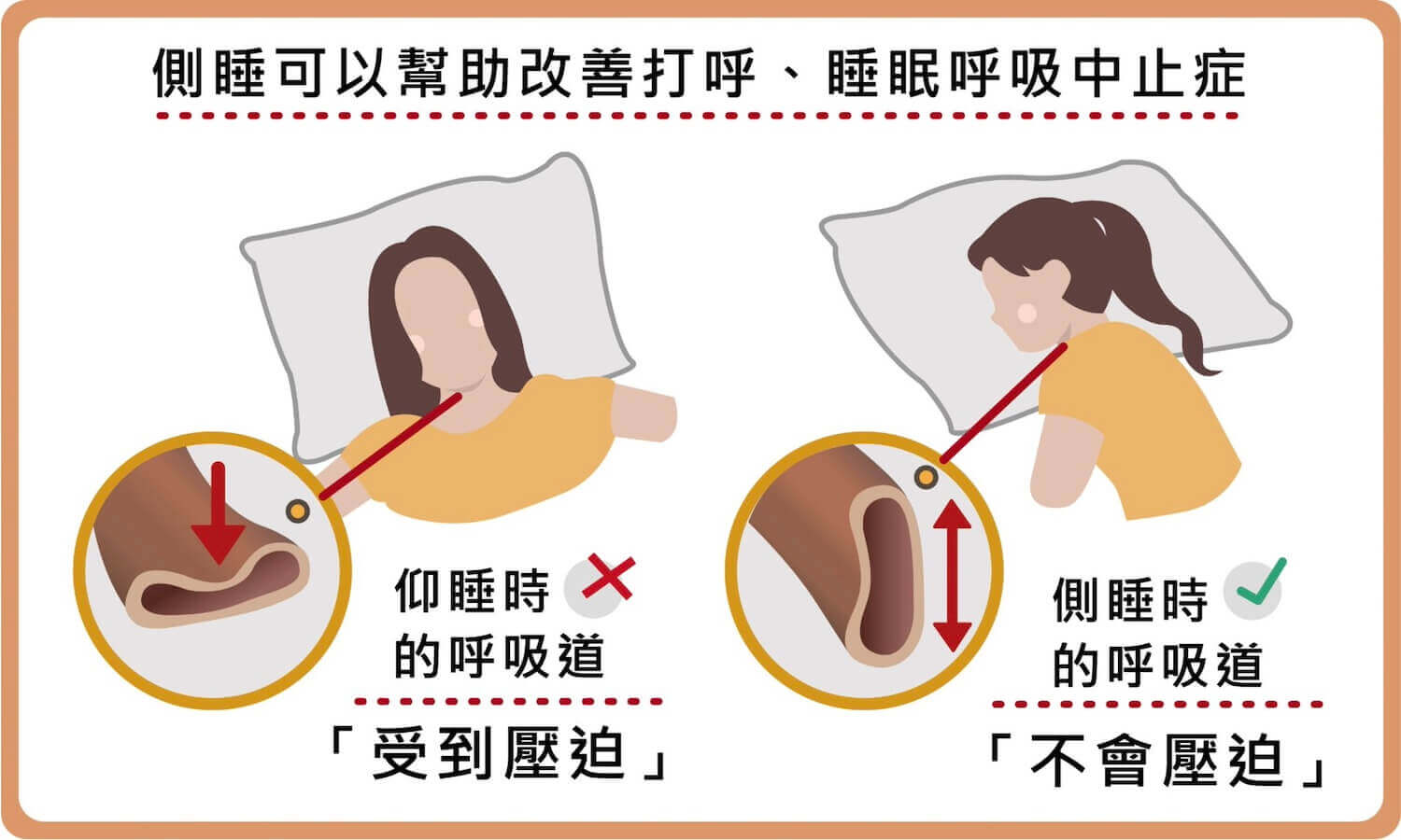 為什麼會打呼?原因及改善方法?與睡眠呼吸中止症關係?