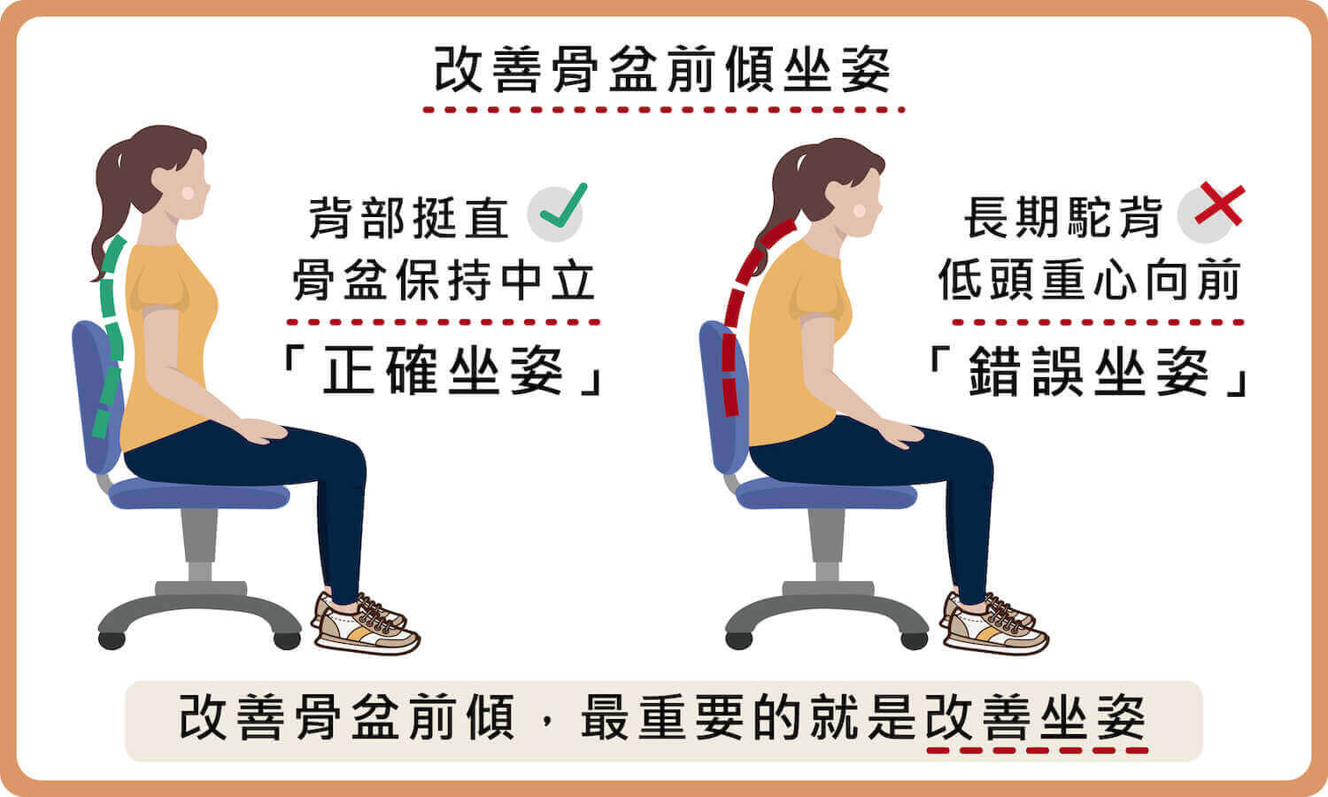 骨盆前傾矯正法？改善坐姿？骨盆前傾看哪科？