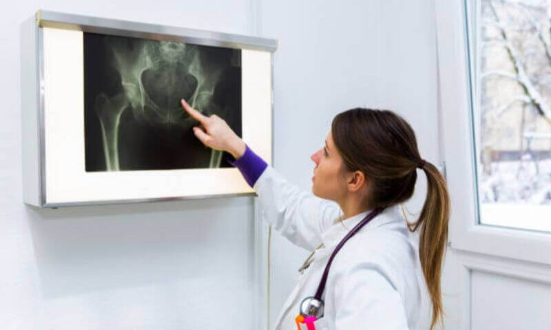 骨盆前傾問題，可以先去醫院掛號骨科照X光.jpg