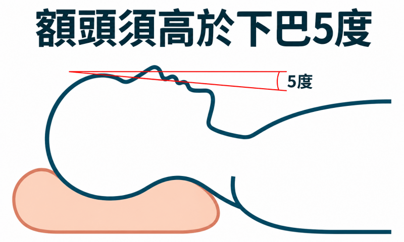 仰睡躺枕頭時額頭須高於下巴5度