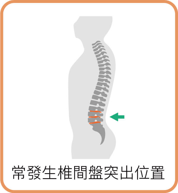 常發生椎間盤突出位置