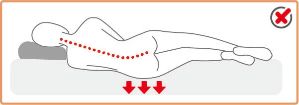 彈簧支撐性不足導致臀部下陷