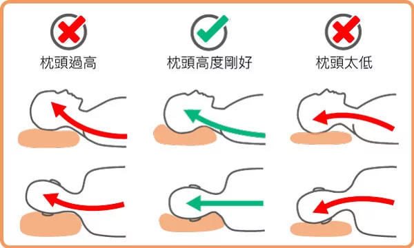 枕頭高度不正確導致脊椎過度彎曲3