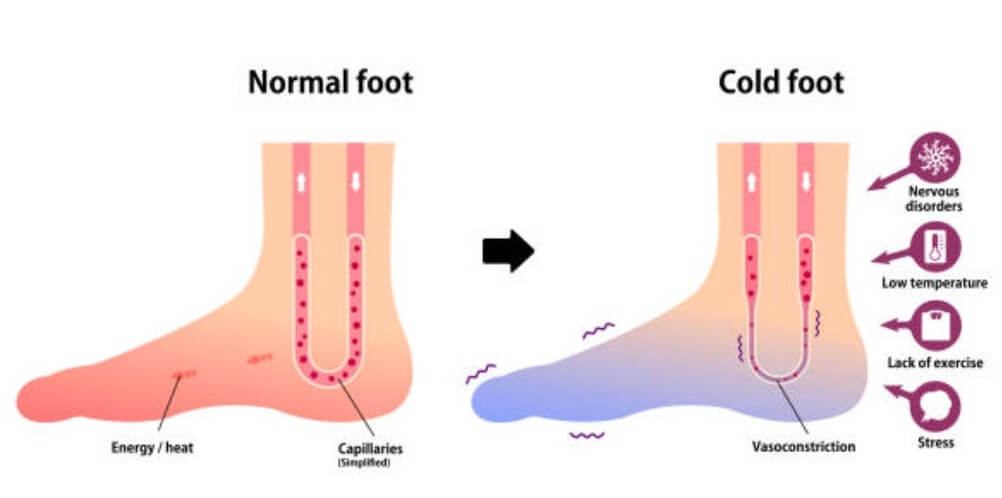 正常四肢血液循環好，手腳冰冷血液循環不良比較