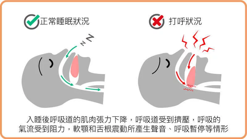 正常睡覺狀況與打呼狀況比較