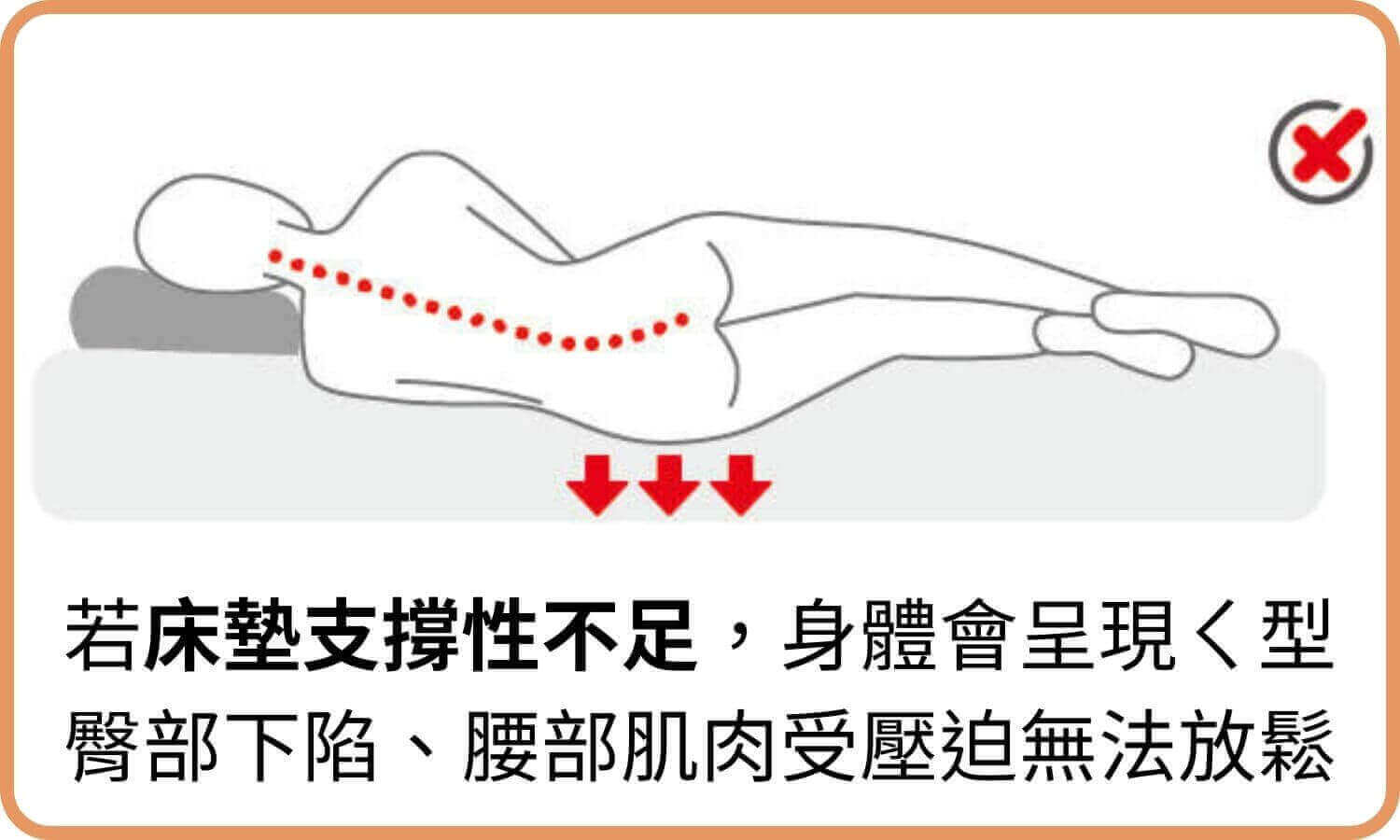 若床墊支撐性不足，身體會呈現ㄑ型，臀部下陷、腰部肌肉受壓迫無法放鬆