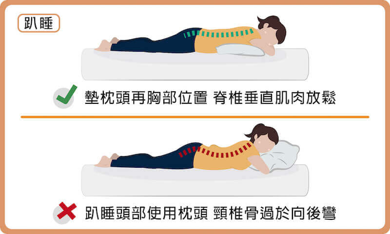 趴睡時可以在胸部位置墊厚毛巾或小抱枕，避免脊椎肌肉受到壓迫，頭部不睡枕頭能防止頸椎骨過於向後彎。