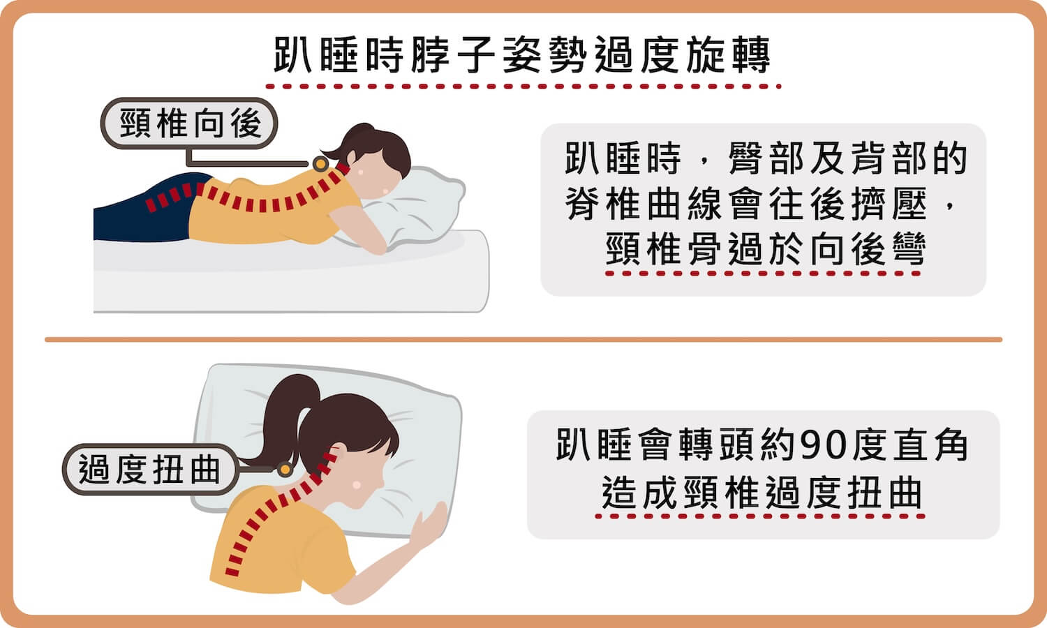 趴睡容易會擠壓脊椎，且脖子旋轉姿勢會讓頸椎過度扭曲
