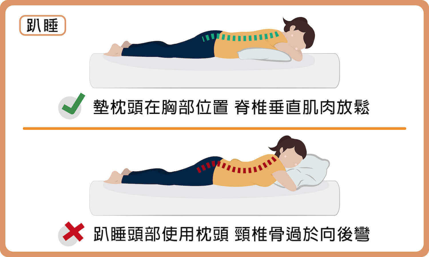 趴睡時可以在胸部位置墊枕頭或毛巾，幫助脊椎肌肉放鬆；趴睡時頭部不要睡枕頭，以免頸椎骨過於向後彎、脊椎受到壓迫。
