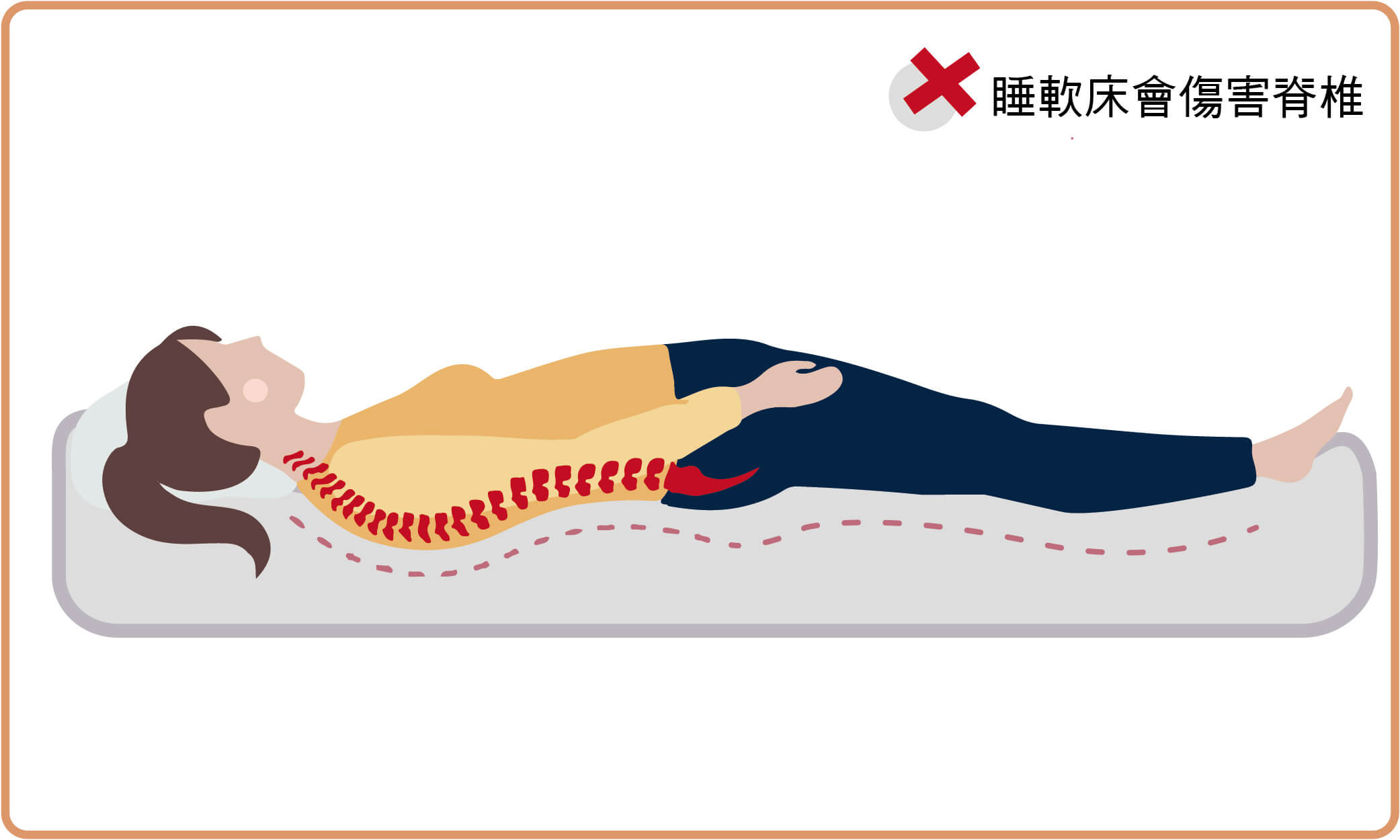 駝背睡太軟的床墊會傷害脊椎