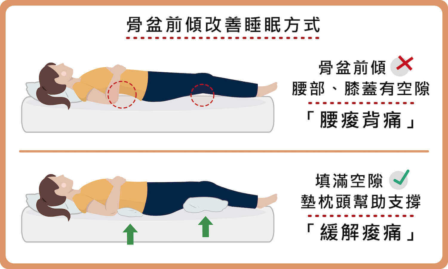 骨盆前傾可在腰部膝蓋下墊枕頭，幫助支撐、緩解疼痛