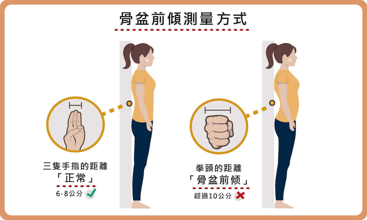 骨盆前傾測量方式與結果